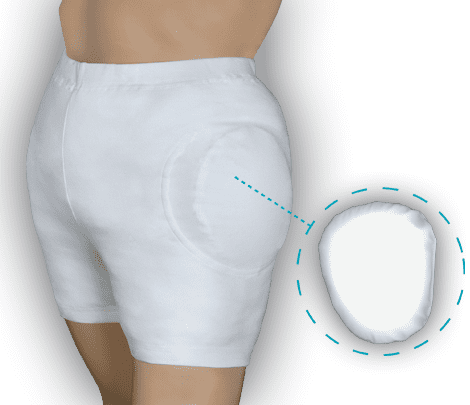 ADL Hüftschutzhose propant ADL propant - Hüftschutzhose mit 2 weichen Protektoren Die ADL Hüftschutzhose propant dient zur Sturzprophylaxe. Durch Tragen der Hüftschutzhose wird die Gefahr einer Oberschenkelhalsfraktur im Falle eines Sturzes gemindert.  Technische Informationen: Material : 97 % Baumwolle