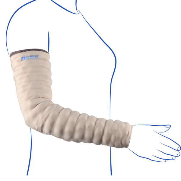 Thuasne Mobiderm Armstrumpf Ödemtherapie 1+   beige   lang Die Thuasne Mobiderm Artikel können zur Entstauung durch Mobilisierung des Unterhautgewebes verwendet werden. Es handelt sich um Schaumstoffwürfel